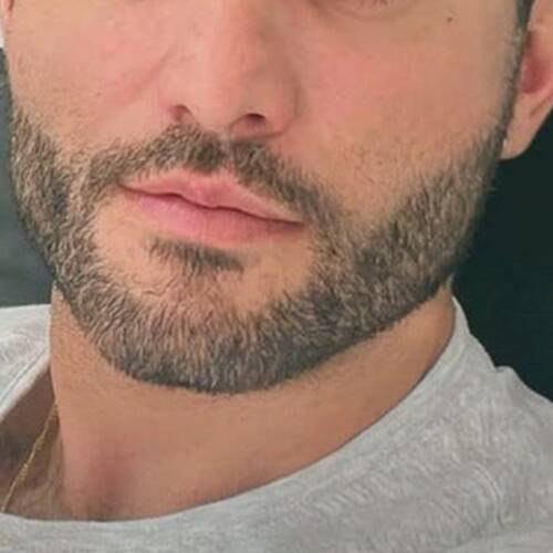 Foto extra 5