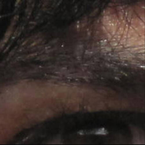 Foto extra 1
