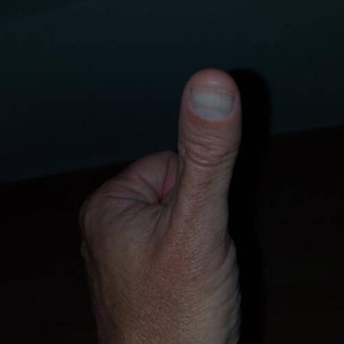 Foto extra 1