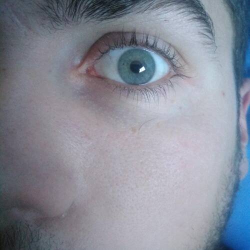 Foto extra 1