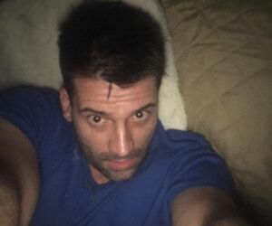 Alberto