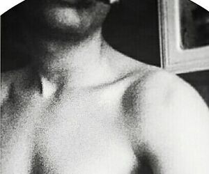 Scarr