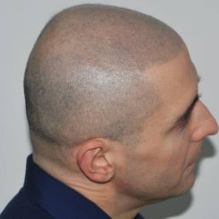 Foto de perfil